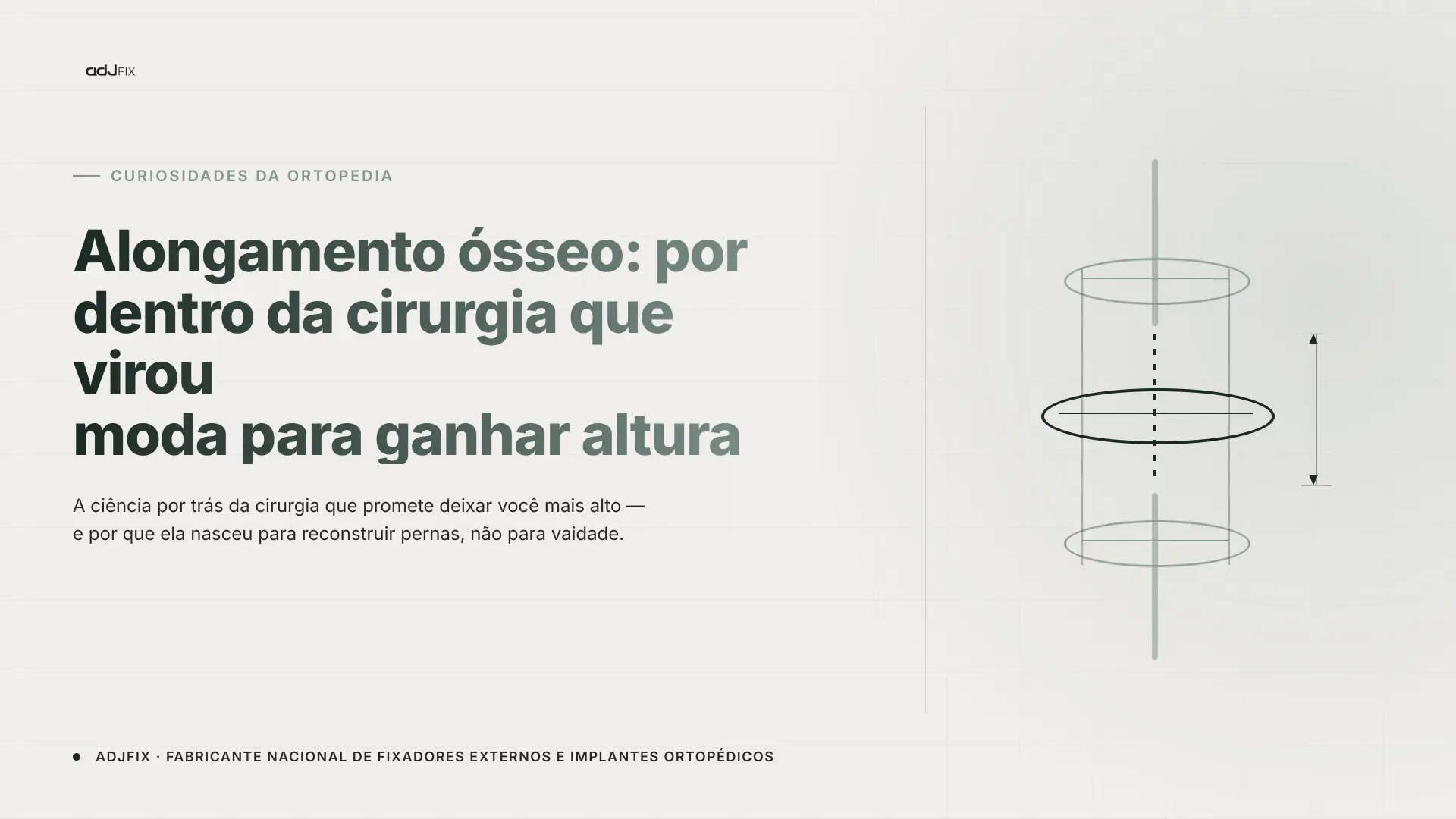 Capa do artigo sobre alongamento ósseo com ilustração técnica de fixador externo circular em diagrama de medição